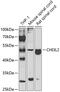Chitinase 3 Like 2 antibody, 23-084, ProSci, Western Blot image 