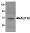 NLR Family Pyrin Domain Containing 10 antibody, PA5-21025, Invitrogen Antibodies, Western Blot image 