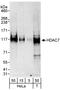 Histone Deacetylase 7 antibody, A301-384A, Bethyl Labs, Western Blot image 