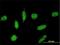 TOP1 Binding Arginine/Serine Rich Protein antibody, H00010210-M02, Novus Biologicals, Immunocytochemistry image 