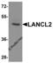 LanC Like 2 antibody, 8369, ProSci, Western Blot image 
