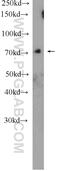 Voltage-dependent L-type calcium channel subunit beta-2 antibody, 21801-1-AP, Proteintech Group, Western Blot image 