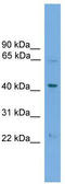 Podocalyxin Like 2 antibody, TA341983, Origene, Western Blot image 