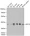 Elongation factor 1-delta antibody, 18-678, ProSci, Western Blot image 