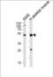 5'-Nucleotidase, Cytosolic IA antibody, PA5-49557, Invitrogen Antibodies, Western Blot image 