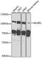 MLX Interacting Protein Like antibody, A03145, Boster Biological Technology, Western Blot image 