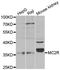 ACTH receptor antibody, TA327478, Origene, Western Blot image 