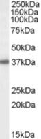 Uncharacterized protein C18orf8 antibody, 45-886, ProSci, Enzyme Linked Immunosorbent Assay image 