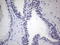 Homeobox protein Nkx-3.1 antibody, TA805135S, Origene, Immunohistochemistry paraffin image 