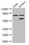 Prolyl 3-Hydroxylase 2 antibody, CSB-PA815555HA01HU, Cusabio, Western Blot image 