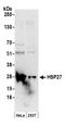 Heat Shock Protein Family B (Small) Member 1 antibody, A304-709A, Bethyl Labs, Western Blot image 