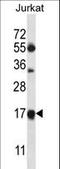Mitochondrial Ribosomal Protein L41 antibody, LS-C158302, Lifespan Biosciences, Western Blot image 