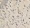 SHOC2 Leucine Rich Repeat Scaffold Protein antibody, A07214-1, Boster Biological Technology, Immunohistochemistry paraffin image 