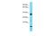 Family With Sequence Similarity 133 Member B antibody, A16251, Boster Biological Technology, Western Blot image 