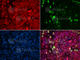 ABL Proto-Oncogene 1, Non-Receptor Tyrosine Kinase antibody, AP0003, ABclonal Technology, Immunofluorescence image 