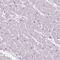 Immunoglobulin Like And Fibronectin Type III Domain Containing 1 antibody, PA5-62187, Invitrogen Antibodies, Immunohistochemistry frozen image 