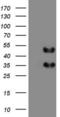 FosB Proto-Oncogene, AP-1 Transcription Factor Subunit antibody, LS-C339088, Lifespan Biosciences, Western Blot image 