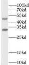 Lysyl Oxidase antibody, FNab04823, FineTest, Western Blot image 
