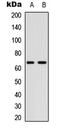 M-phase inducer phosphatase 2 antibody, GTX55005, GeneTex, Western Blot image 