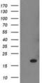 Retinol Binding Protein 1 antibody, NBP2-00637, Novus Biologicals, Western Blot image 