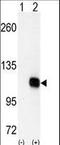 Diacylglycerol Kinase Zeta antibody, LS-C101153, Lifespan Biosciences, Western Blot image 