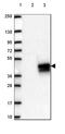V-Set And Immunoglobulin Domain Containing 2 antibody, HPA050147, Atlas Antibodies, Western Blot image 