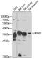 Barttin CLCNK Type Accessory Beta Subunit antibody, 23-152, ProSci, Western Blot image 