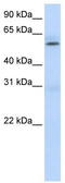 Protein arginine N-methyltransferase 3 antibody, TA345674, Origene, Western Blot image 