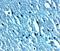 Transient Receptor Potential Cation Channel Subfamily C Member 3 antibody, GTX31626, GeneTex, Immunohistochemistry paraffin image 