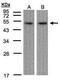 Cyclic AMP-dependent transcription factor ATF-7 antibody, PA5-28130, Invitrogen Antibodies, Western Blot image 