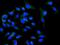 NADPH oxidase 5 antibody, A03090, Boster Biological Technology, Immunofluorescence image 