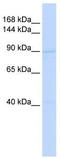 RAD54 Homolog B antibody, TA341585, Origene, Western Blot image 