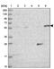 Kelch Like Family Member 35 antibody, PA5-58705, Invitrogen Antibodies, Western Blot image 