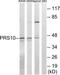 Proteasome 26S Subunit, ATPase 6 antibody, TA312060, Origene, Western Blot image 