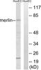 SCH antibody, LS-C118180, Lifespan Biosciences, Western Blot image 