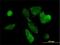 Phosphoenolpyruvate Carboxykinase 1 antibody, H00005105-M01, Novus Biologicals, Immunocytochemistry image 