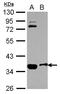 Osteopetrosis-associated transmembrane protein 1 antibody, LS-C155312, Lifespan Biosciences, Western Blot image 