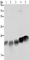 NADH dehydrogenase [ubiquinone] iron-sulfur protein 8, mitochondrial antibody, TA350220, Origene, Western Blot image 
