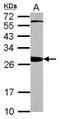 Tyrosine 3-Monooxygenase/Tryptophan 5-Monooxygenase Activation Protein Beta antibody, TA308715, Origene, Western Blot image 
