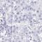 Leucine Rich Repeat Containing 37A antibody, HPA042121, Atlas Antibodies, Immunohistochemistry paraffin image 