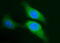 Sphingosine kinase 1 antibody, M01390-1, Boster Biological Technology, Immunofluorescence image 