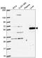 DENN Domain Containing 6A antibody, HPA062618, Atlas Antibodies, Western Blot image 