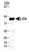 Lysyl Oxidase antibody, TA301771, Origene, Western Blot image 