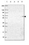 Asparaginase antibody, HPA069761, Atlas Antibodies, Western Blot image 