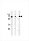 Protein Kinase AMP-Activated Non-Catalytic Subunit Gamma 3 antibody, TA324610, Origene, Western Blot image 