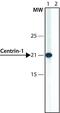 Calt antibody, GTX11257, GeneTex, Western Blot image 
