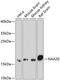 N(Alpha)-Acetyltransferase 20, NatB Catalytic Subunit antibody, 22-702, ProSci, Western Blot image 