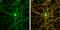 Glutamate Ionotropic Receptor NMDA Type Subunit 2B antibody, GTX109713, GeneTex, Immunocytochemistry image 