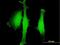 Cytosolic carboxypeptidase-like protein 5 antibody, H00060509-B01P, Novus Biologicals, Immunocytochemistry image 
