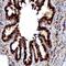 NME1 antibody, FNab10803, FineTest, Immunohistochemistry frozen image 